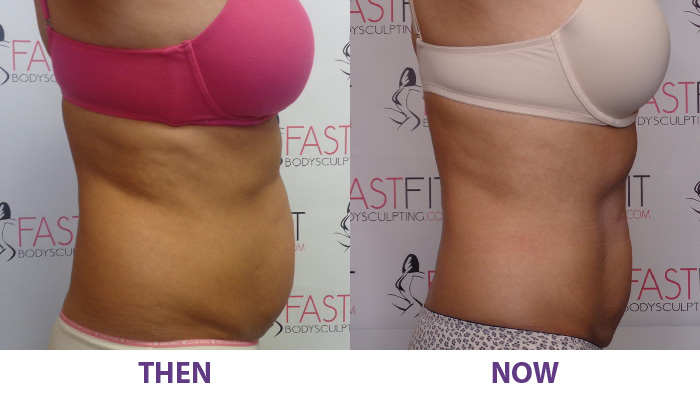 before and after fast fit susie