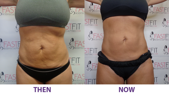 before and after fast fit dawn