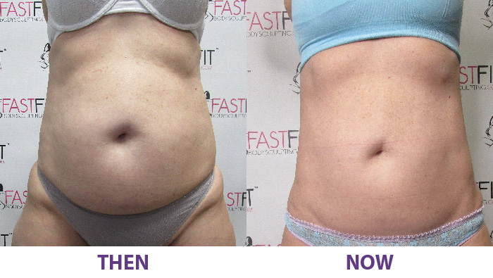before and after fast fit judy