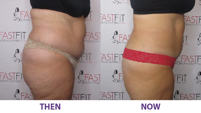 before and after fast fit melissa