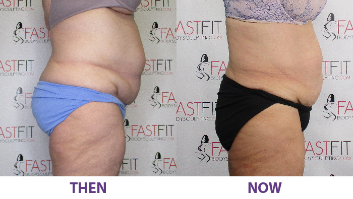 before and after fast fit vicky