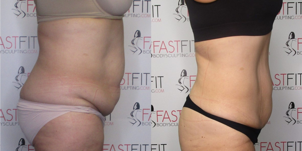 fast fit body sculpting weight loss review joni