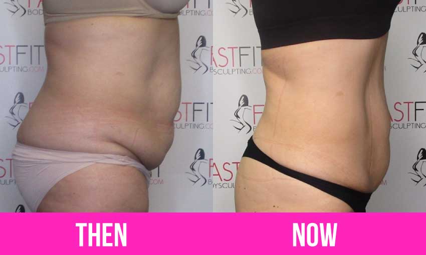 fast fit client amazing weight loss transformation before and after