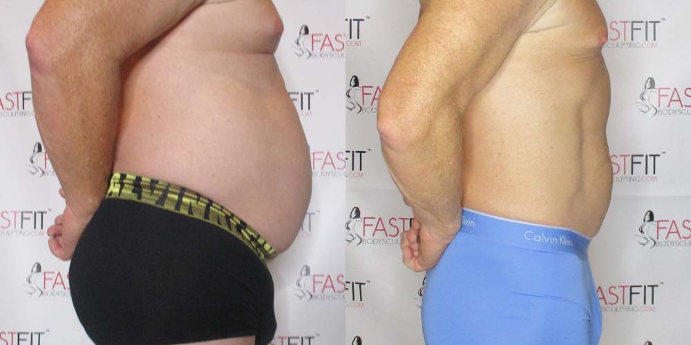 fast fit client before and after erick
