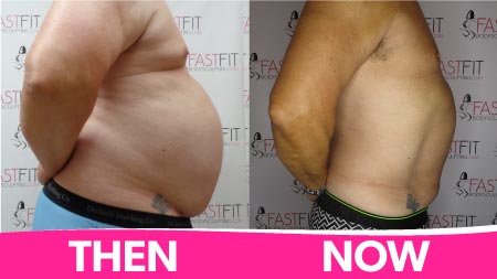 fast-fit-body-sculpting-before-and-after-picture-weight-loss-ben