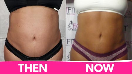 fast-fit-body-sculpting-before-and-after-picture-weight-loss-cappi