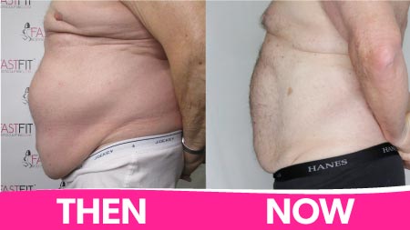 fast-fit-body-sculpting-before-and-after-picture-weight-loss-frank