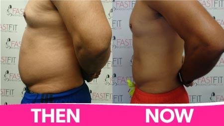 fast-fit-body-sculpting-before-and-after-picture-weight-loss-kevin