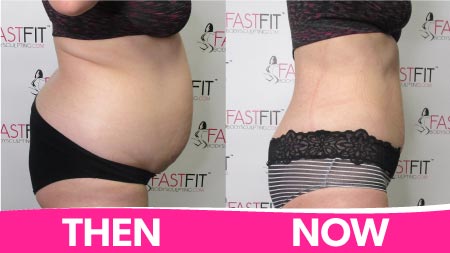 fast-fit-body-sculpting-before-and-after-picture-weight-loss-nicole