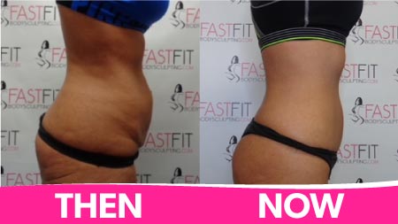 fast-fit-body-sculpting-before-and-after-picture-weight-loss-vera