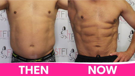 fast-fit-body-sculpting-before-and-after-picture-weight-loss-jose