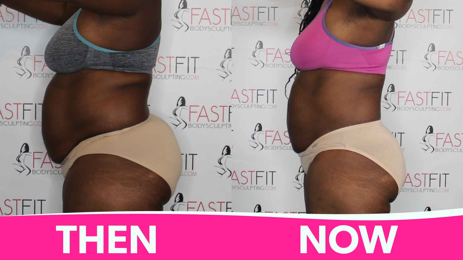 Results - Fast Fit Body Sculpting